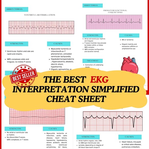 Rapid EKG Interpretation & Heart Arrhythmias Cheat Sheet ,cheat Sheets Bundle Easy Interpreting ,ekg Interpretation ,CCRN ,icu,ecg Rhythms - Etsy