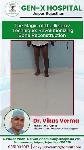 The Magic of the Ilizarov Technique: Revolutionizing Bone Reconstruction