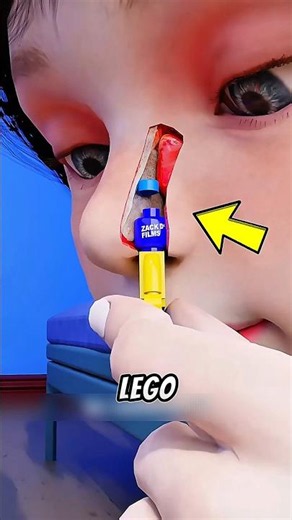 LEGO Stuck in Your Nose? Don’t Do This 😳