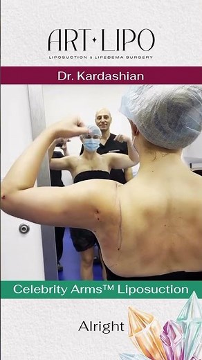 Sculpted to Perfection by Dr. George Kardashian | Celebrity Arms™ & Upper Back/Axilla Liposuction! 🔥