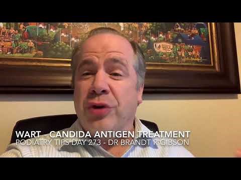 Wart - Candida Antigen Treatment