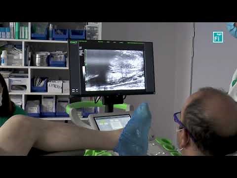 Biopsia próstata CHGUV