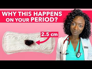 💩 Period Poop & Other Weird Things That Happen During Your Period