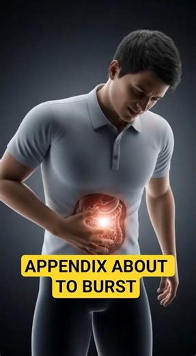 What Happens During Appendicitis? (3D Medical Animation)