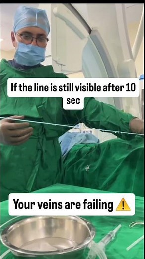 Are your veins leaking? Try this simple test #vascularsurgeon #doctoradvice