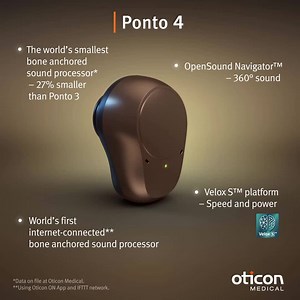 72K views · 157 reactions | Smallest size without compromise. Ponto 4 comes with the full wireless capability, state-of-the-art technology and renowned quality of the Ponto™ System in the smallest size to date among bone achored hearing devices. Learn more: | Oticon Medical | Facebook