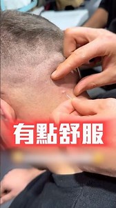 他脖子痛了好幾個月但醫生馬上找到原因😯 #shorts