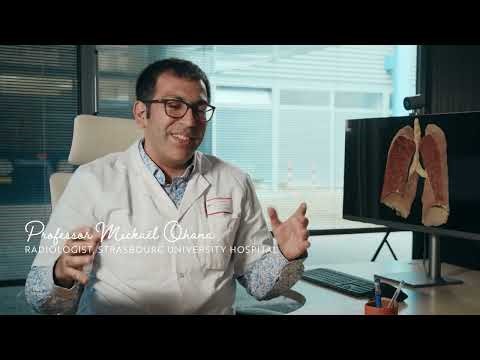 Detecting cancer earlier with AI – How better image quality can help detect early stage lung cancer