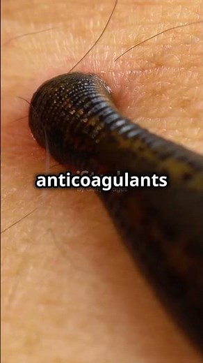 How Leeches Suck Blood Painlessly!