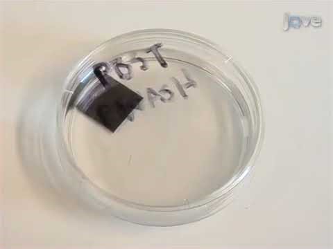 Interferometric Reflectance Imaging Sensor (IRIS) for biomolecular detection