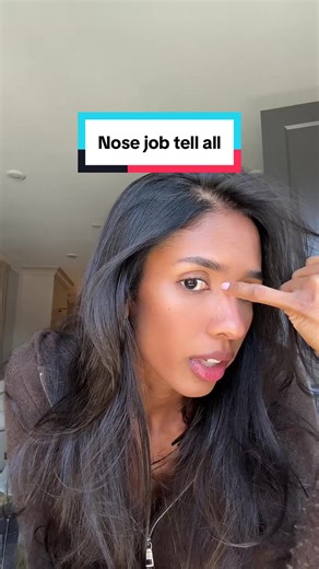 Nose Job Tell All: Avoiding Botched Rhinoplasty