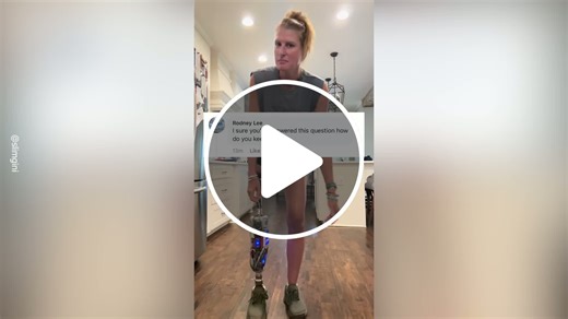 Woman Shares Incredible Prosthesis Mechanism - NewsBreak