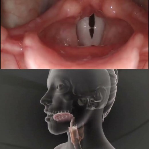 Sounds Production by Vocal Cord