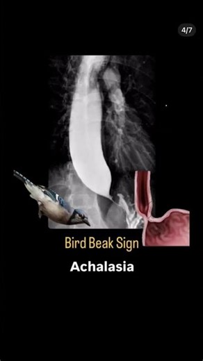 Imo radiological signs