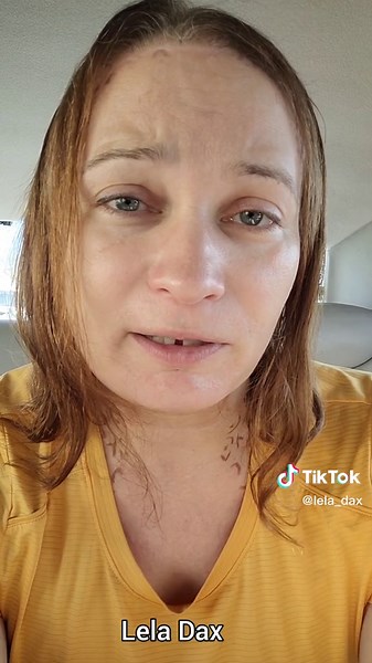 Understanding Autogynophelia: My Journey to Self-Discovery