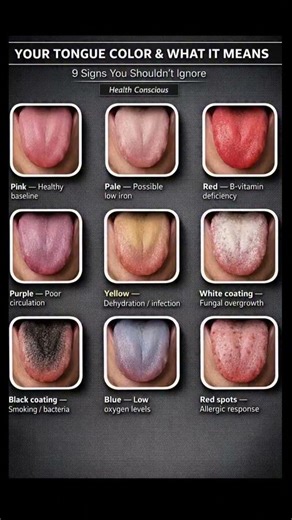 YOUR TONGUE COLOR & WHAT IT MEANS 🤯 #shorts