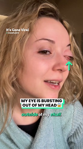 4.3M views · 13K reactions | My eyeball drama is freaking out the internet  | IGV | Facebook