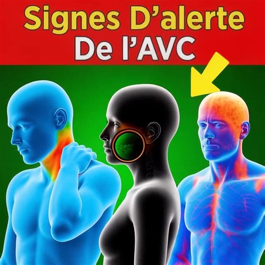 1.2K views | 7 symptômes de l'AVC - ce que vous devez savoir ! (lien en commentaire) | Les Meilleures Blagues | Facebook