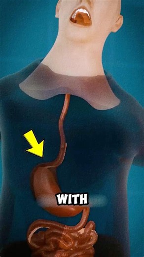 You Swallowed Tapeworm Eggs 😨🪱