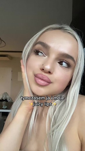 Lip Filler Transformation: Juicy Lips Reveal