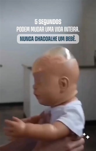 Nunca balance ou chacoalhe um bebê, pois isso pode causar lesões cerebrais irreversíveis ou morte. O impacto faz com que o cérebro colida contra o crânio, resultando em hemorragias e danos permanentes conhecidos como Síndrome do Bebê Sacudido. Se estiver estressado com o choro, coloque o bebê em um local seguro, afaste-se por alguns minutos e respire fundo antes de retornar. Jamais sacuda. #bebesacudido #bebe #cuidadoscomobebe