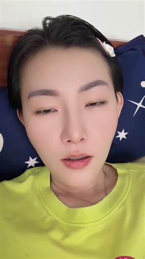 How to Remove Acne Scars and Blemishes: Tips from Personal Experience
