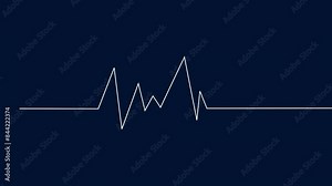 heartbeat rate and pulse animation. Heart rate electrocardiogram medical monitor.