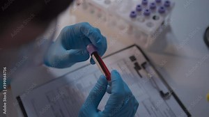 Doctor holding Coronavirus 2019-nCoV blood sample. Concept of vaccination, Covid 19 diagnostic. Diagnosis and laboratory. Scientist with positive coronavirus test. Detection virus infected. Pandemic