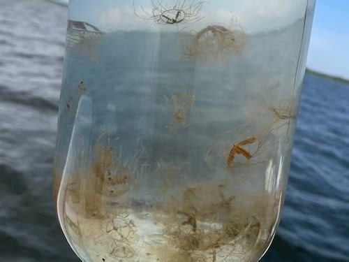 Toxic clinging jellyfish with ‘excruciating’ sting spotted near Jersey Shore