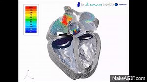 FlowVision CFD   Living Heart – Blood Velocity with Mechanical Valves on Make a GIF