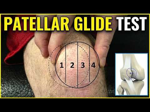 Patellar Glide Test | Patellar Hypermobility