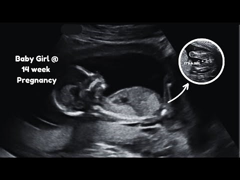 Baby Girl Ultrasound Scan at 14 Weeks Pregnancy | How the Baby Looks at 14 weeks