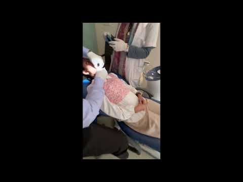 Interproximal Reduction Treatment