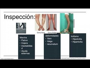 Exploración Física de Rodilla