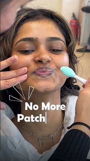 How to Lighten Dark Lips Naturally | Lip Brightening Home Remedy