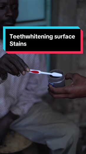 Teeth whitening with Tooth Savior powder | Surface stain removal