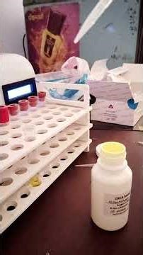 process of creatinin test , creatinine blood test