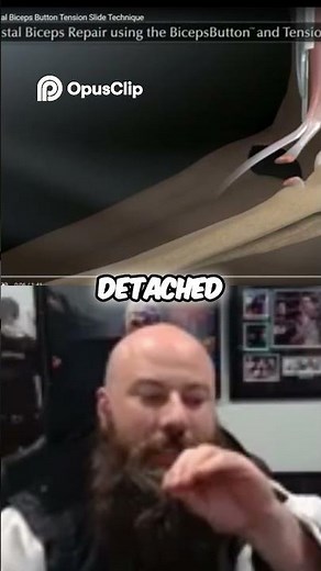 Distal Bicep Repair Step by Step Surgical Procedure