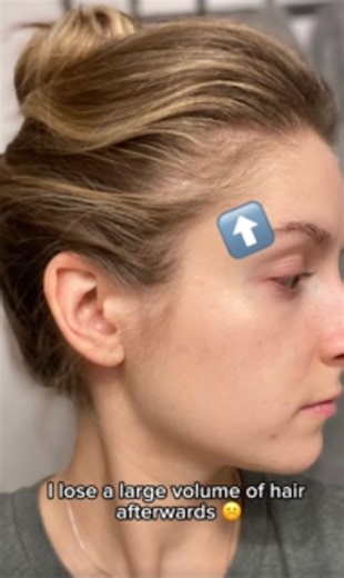 Prevent Hair Loss My Hair Care Routine