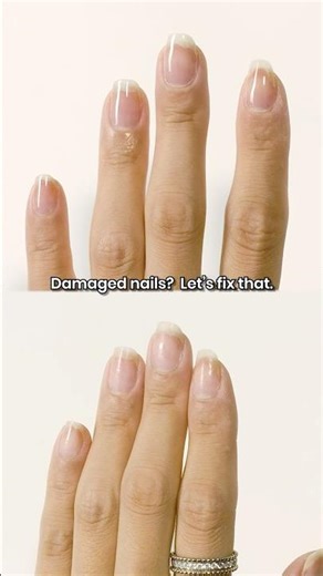 Damaged nails? Let’s fix that. 🌿💅