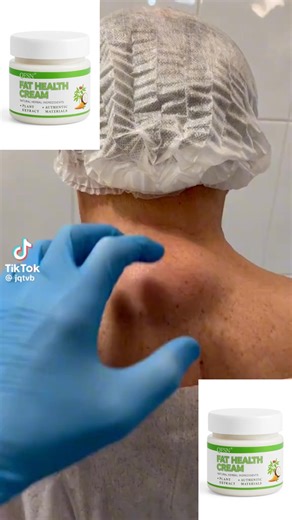 Vous cherchez une alternative plus douce à la chirurgie des lipomes ? Lipoclear est une pommade formulée à base d’ingrédients d’origine naturelle, conçue pour aider à réduire progressivement l’apparence des lipomes avec une application régulière. Des utilisateurs rapportent des changements visibles en quelques semaines pour les lipomes récents, et une amélioration progressive en un à deux mois pour les zones plus importantes. Simple. Non invasif. Plus accessible qu’une opération. Découvrez Lipoc