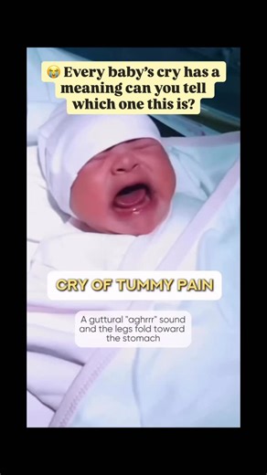 Dr Ambreen S | Gynaecologist | Pregnancy | Laparoscopy on Instagram: "Your baby’s cry isn’t random it’s communication! 💬👶 Learn how to decode every whimper, wail, and whine so you know exactly what your baby needs 🩵 🔊 Common Types of Baby Cries (and what they mean): 1. Hunger Cry 🍽️ — Starts soft, becomes rhythmic “neh-neh” or “aa-aa.” 👉 Feed your baby before it turns into full-blown wailing. 2. Tiredness Cry 😴 — Whiny, breathy cry with yawns or rubbing eyes. 👉 Time to swaddle or rock th