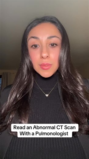 @theicudoctor1 | Comment, share, save!!! Citation: Silverstone L, Fibrotic hypersensitivity pneumonitis. Case study, Radiopaedia.org (Accessed on 20 Dec... | Instagram