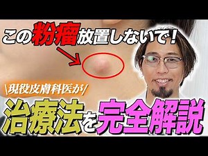 【完全解説】粉瘤ができる原因と正しい治療法とは！？現役皮膚科医が正しいアプローチを徹底解説！【あいちビューティークリニック】