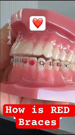 How is the RED Braces Colour for your LOVE ❤️