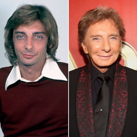 Has Barry Manilow Had Plastic Surgery? See Photos of the Singer’s Transformation Over Time