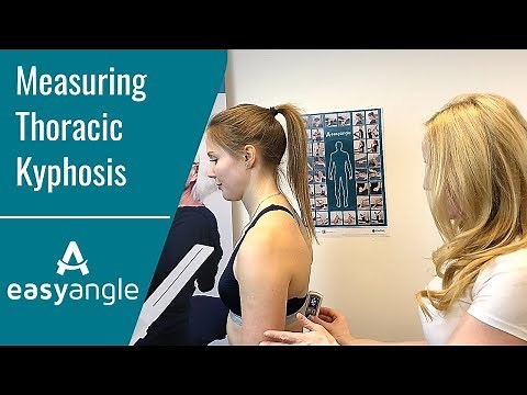 EasyAngle - Measuring Thoracic Kyphosis