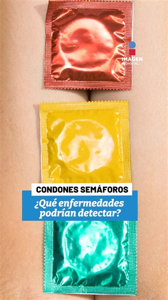 1.6K views · 33 reactions |  Estos son los condones semáforo. Aquí te decimos qué enfermedades podrían detectar. #SaludSexual #ImagenRadioInforma | Imagen Radio | Facebook