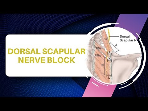 Dorsal Scapular Nerve Injection Technique