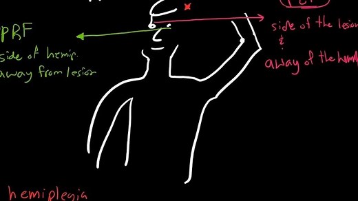 Frontal Eye Fields Vs Paramedian Pontine Reticular Formation PPRF Lesions Explained